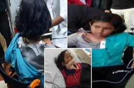 ಖೇಲೋ ಇಂಡಿಯಾ: ಬಾಲಕಿಗೆ ಚುಚ್ಚಿದ ಬಾಣ, ಪ್ರಾಣಾಪಾಯದಿಂದ ಪಾರು